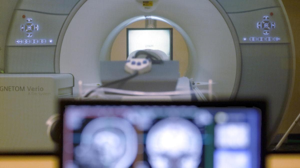 Belly Fat in Middle Age Tied to Slower Brain Deterioration, New Research Reveals